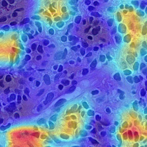 Grad-CAM: INOVA model predicted as control — highlighting lymphocytes in lamina propria