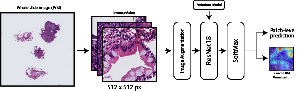 Deep Learning for Pediatric Crohn's Disease