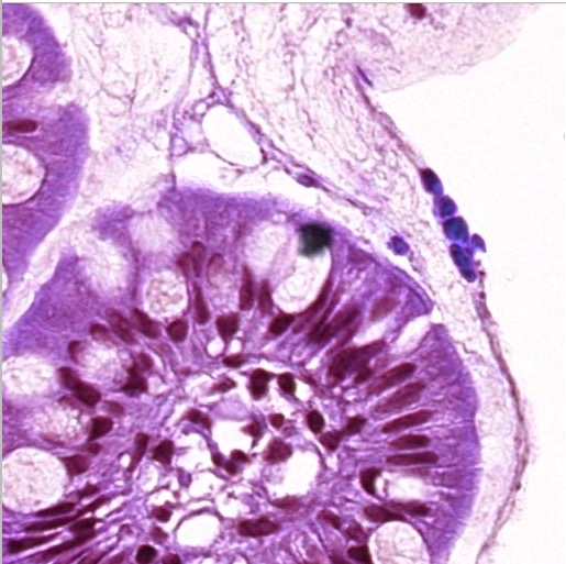 Biopsy after stain normalization using StainTools