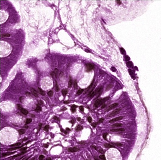 Biopsy before stain normalization — visible color variation between sites