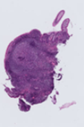CCHMC whole slide image with denser tissue coverage