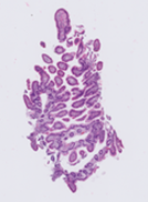 INOVA whole slide image showing increased white space relative to CCHMC